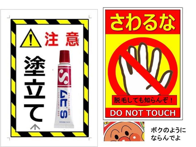 円形脱毛症　病院